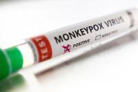 Salud confirmó el segundo caso  de viruela del mono en Argentina