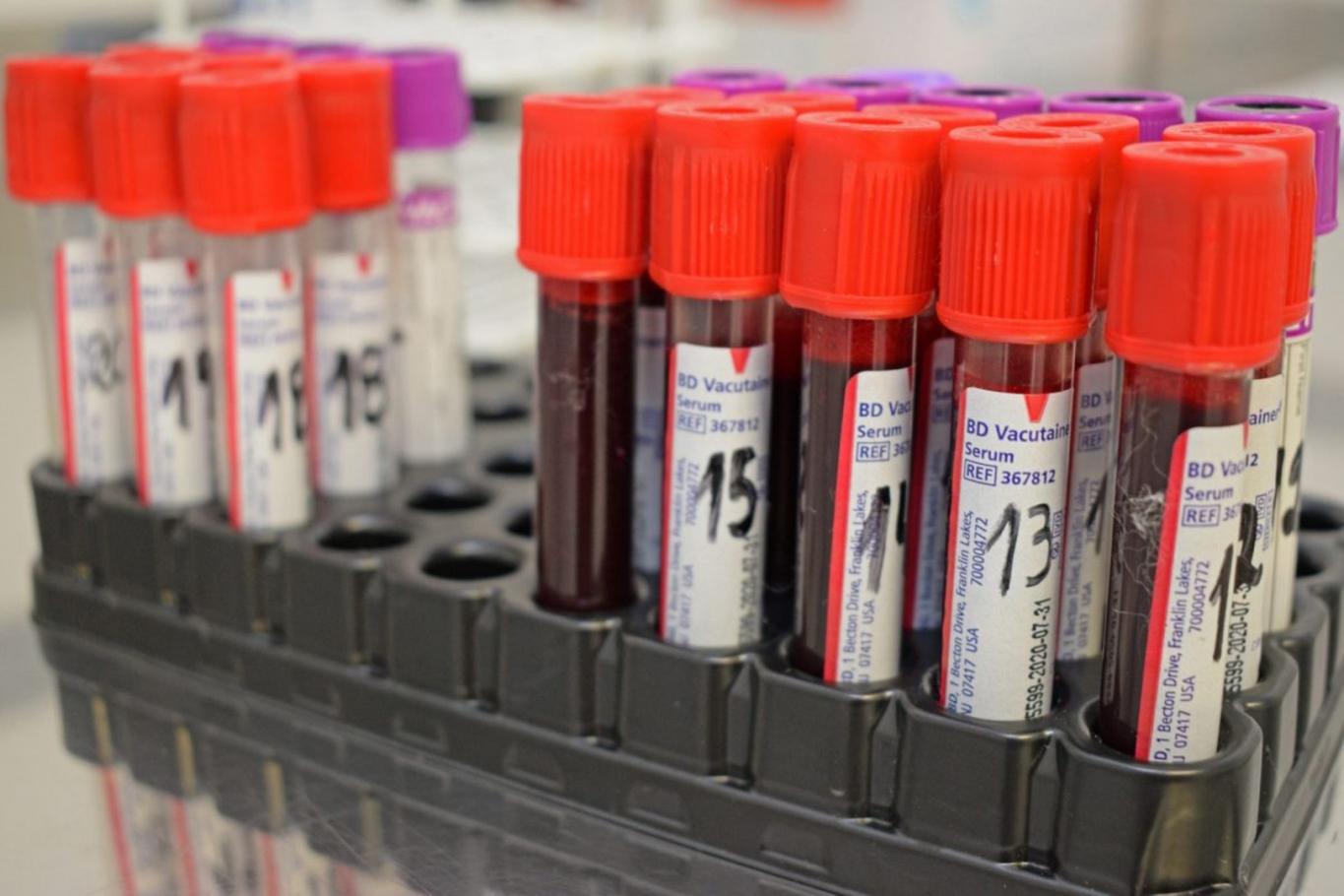 Salud incentiva la donación voluntaria  de sangre en toda la provincia